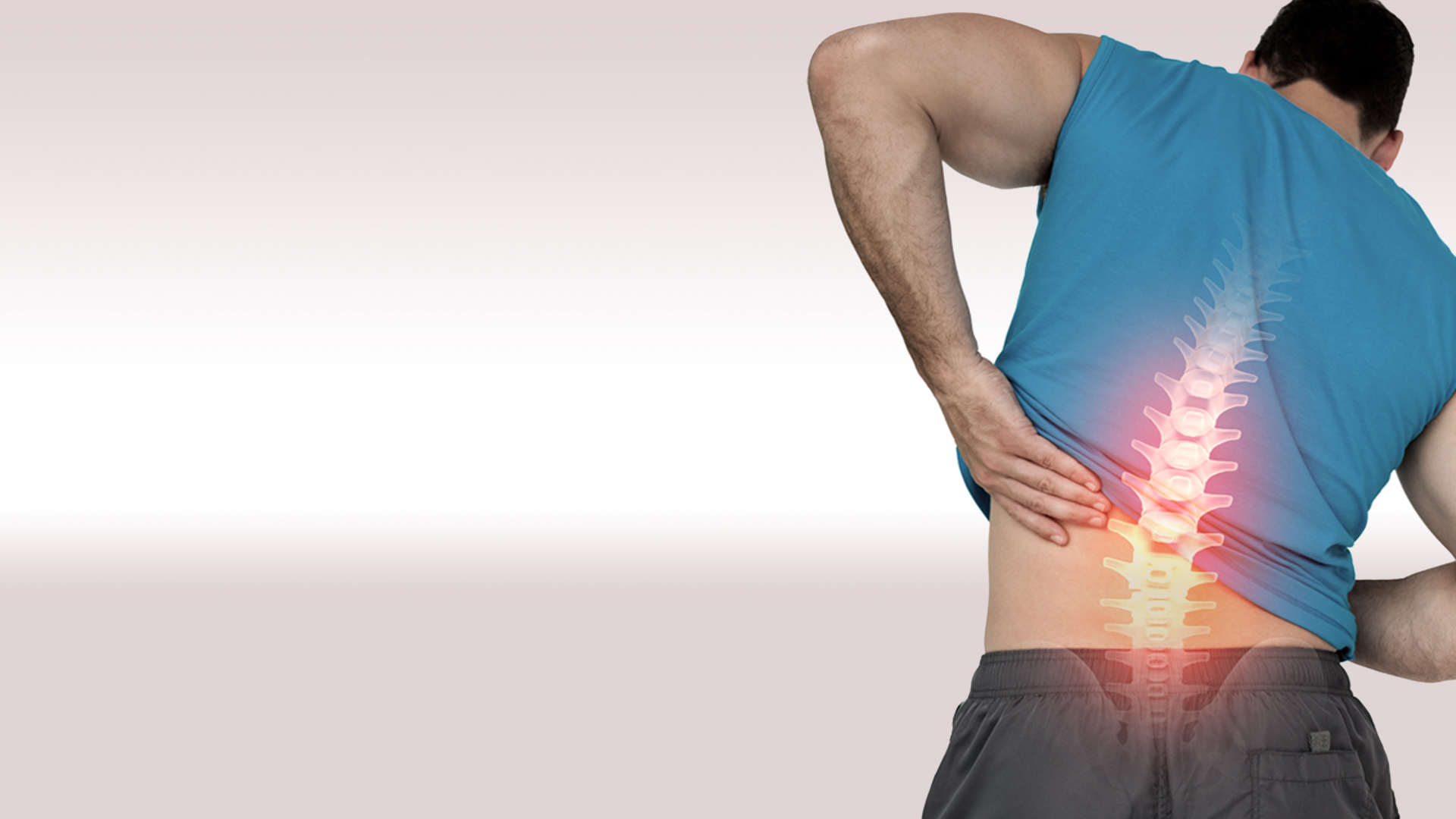 Disc Herniation