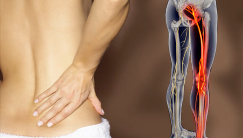 Best Stretches for Sciatic Nerve Pain