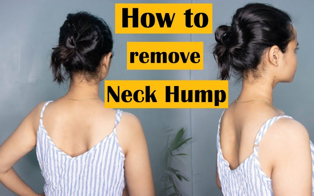 Easy Exercises to Get Rid of the NECK HUMP