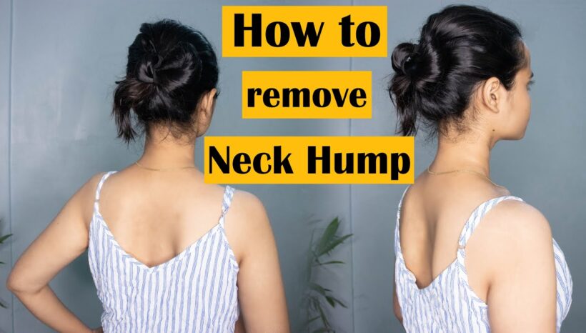 Easy Exercises to Get Rid of the NECK HUMP