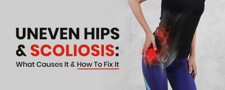 One Hip Higher than the Other? Fix Your Uneven Hips Quickly!
